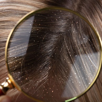 Wat maakt jouw haar Oorzaken van dun haar | ShytoBuy